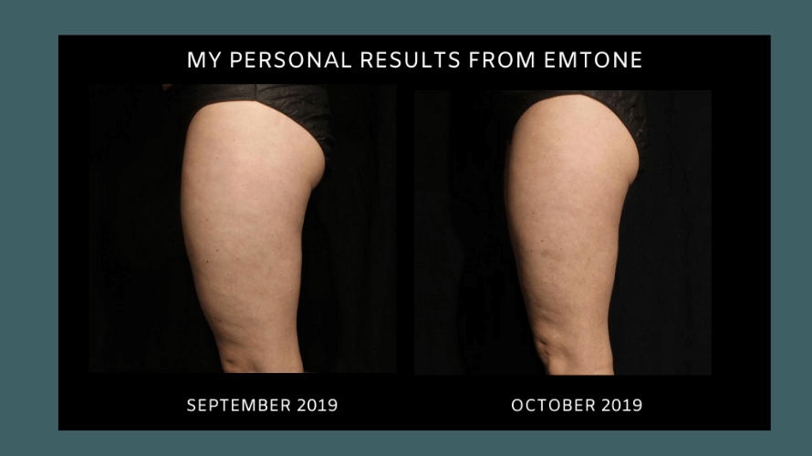 Emtone Results